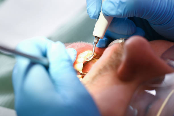 Best Mobile Emergency Dentist in Delta, OH